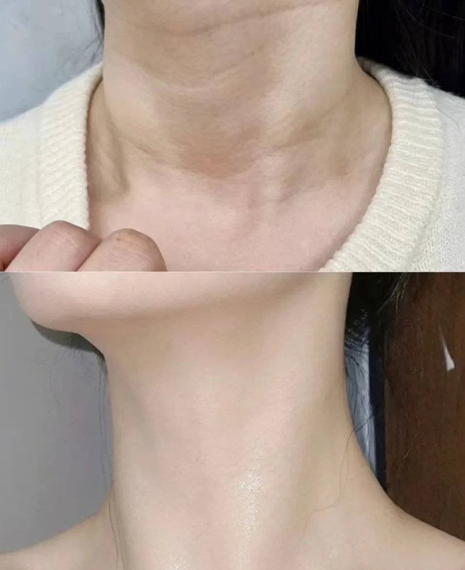 neck-10