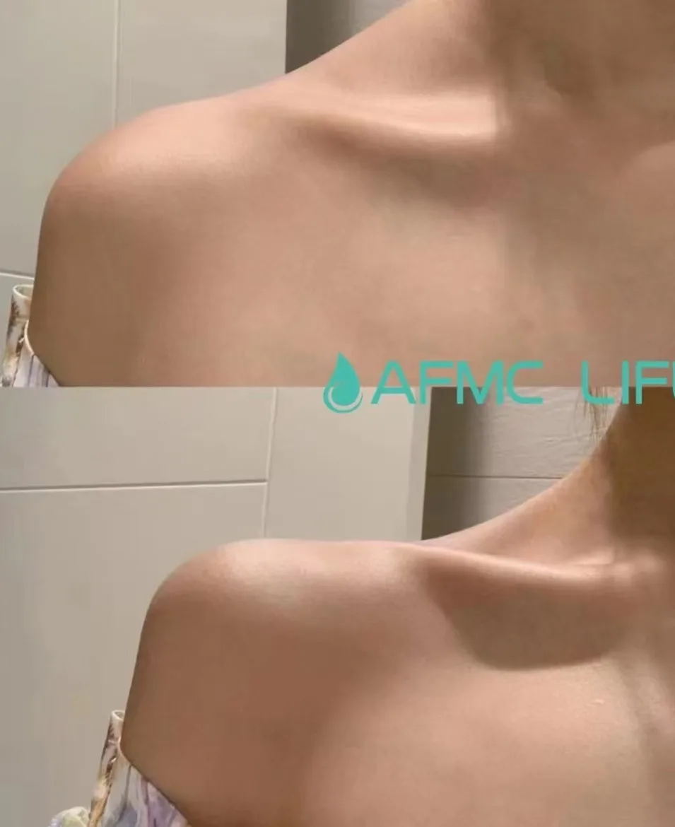 neck-14