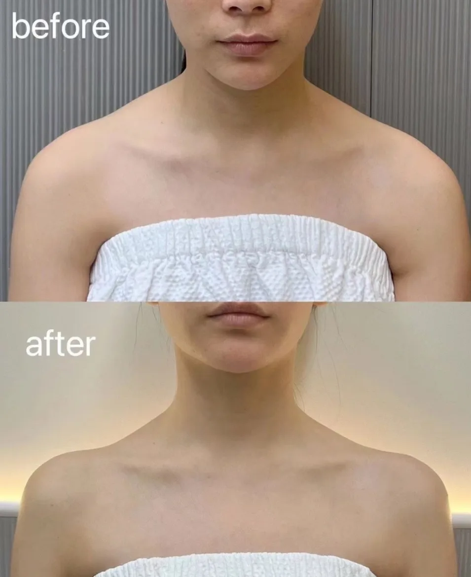 neck-15