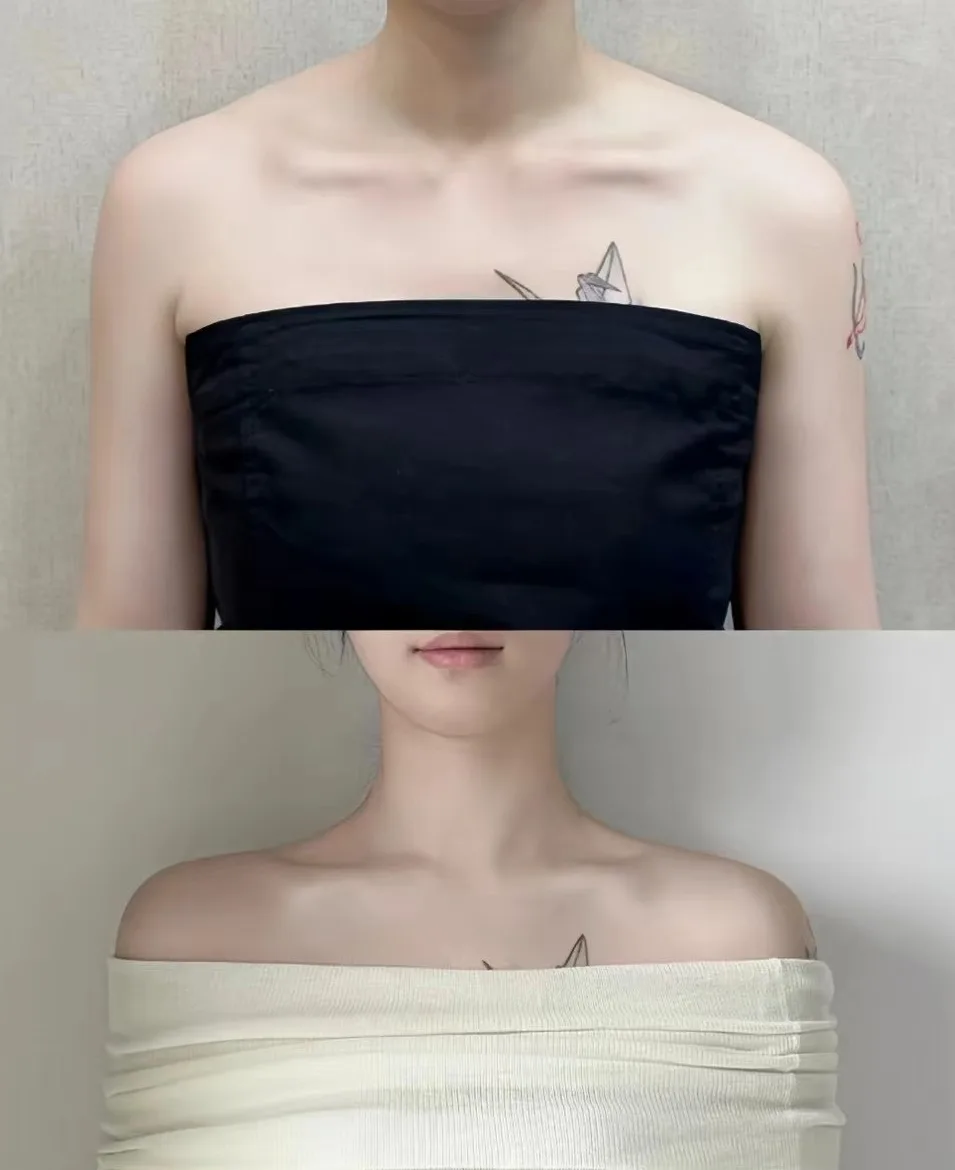 neck-16