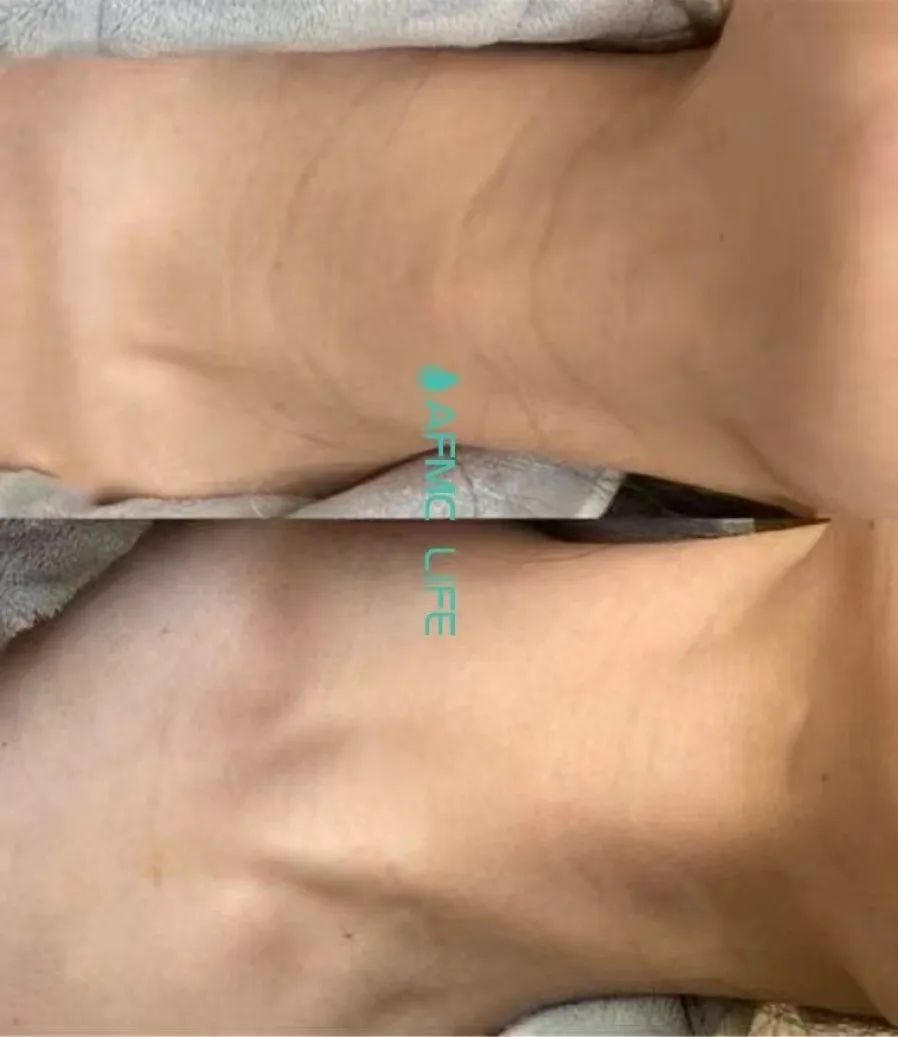 neck2